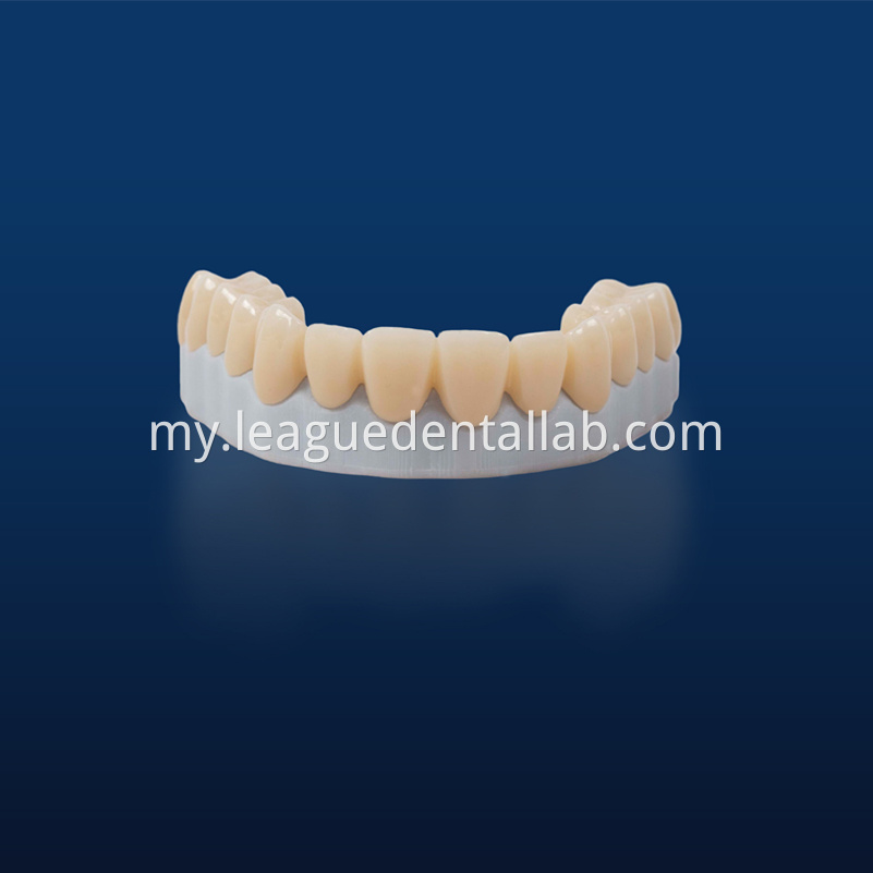 Full Zirconia